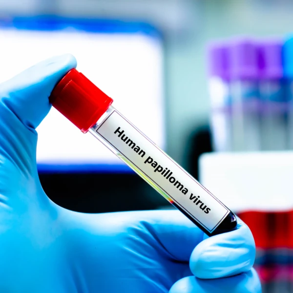 Wat leren we van het datalek bij Bevolkingsonderzoek Nederland